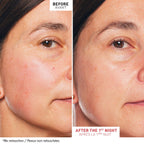 Erborian Skin Therapy - Huile visage multi-perfectrice 30ml