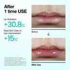 Anua PDRN Hyaluron Lip Serum 10 ml