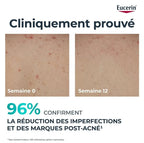 Eucerin dermopurifyer triple effect body cream 200ml